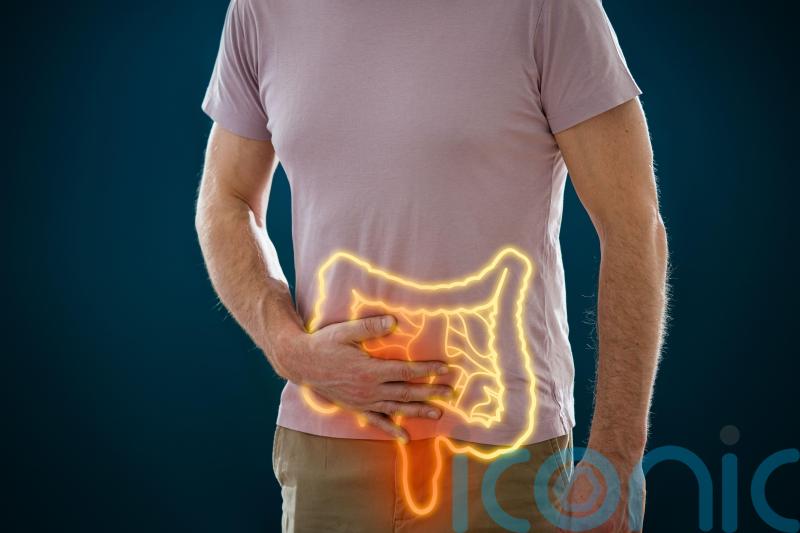 5 key bowel cancer signs to never ignore